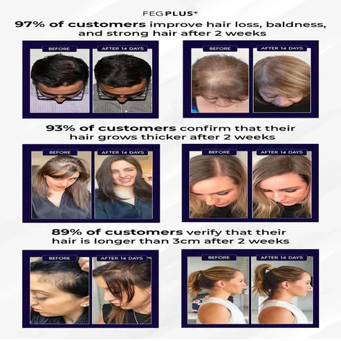 FEG Plus Hair Growth Serum Spray – 50ml (For Men and Women)