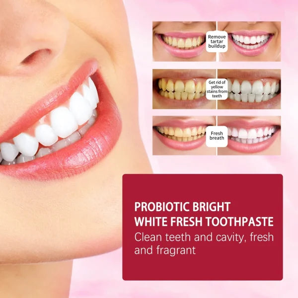 SP-4 Ultra+ Probiotic Whitening Toothpaste